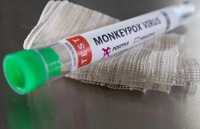 درخواست خرید واکسن علیه موارد احتمالی آبله میمونی / بررسی موارد مشکوک در ۱۲ قطب دانشگاهی
