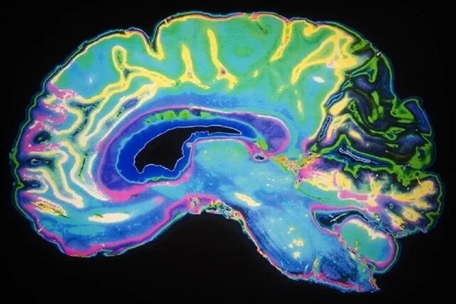 ارائه بینش‌ عمیق‌تری در مورد پیچیدگی مغز انسان