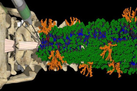 یک درمان تزریقی برای ترمیم آسیب‌های نخاعی