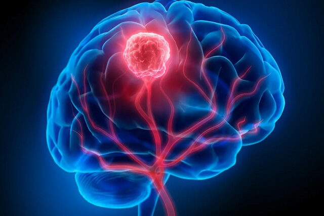 تشخیص و درمان سرطان بوسیله نور برای اولین بار در جهان تشخیص و درمان سرطان بوسیله نور برای اولین بار در جهان