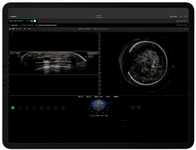 اختراع محقق ایرانی، ناجی جان زنان در جهان