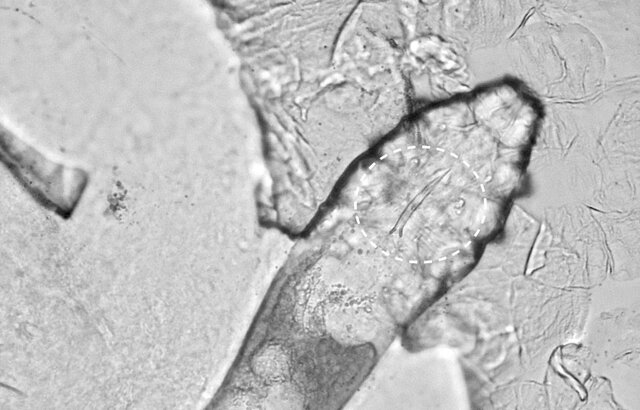 جفتگیری کنهها روی صورت انسانها!