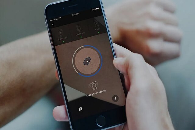 اپلیکیشنهای تشخیص سرطان پوست، جان مردم را به خطر میاندازند! اپلیکیشنهای تشخیص سرطان پوست، جان مردم را به خطر میاندازند!