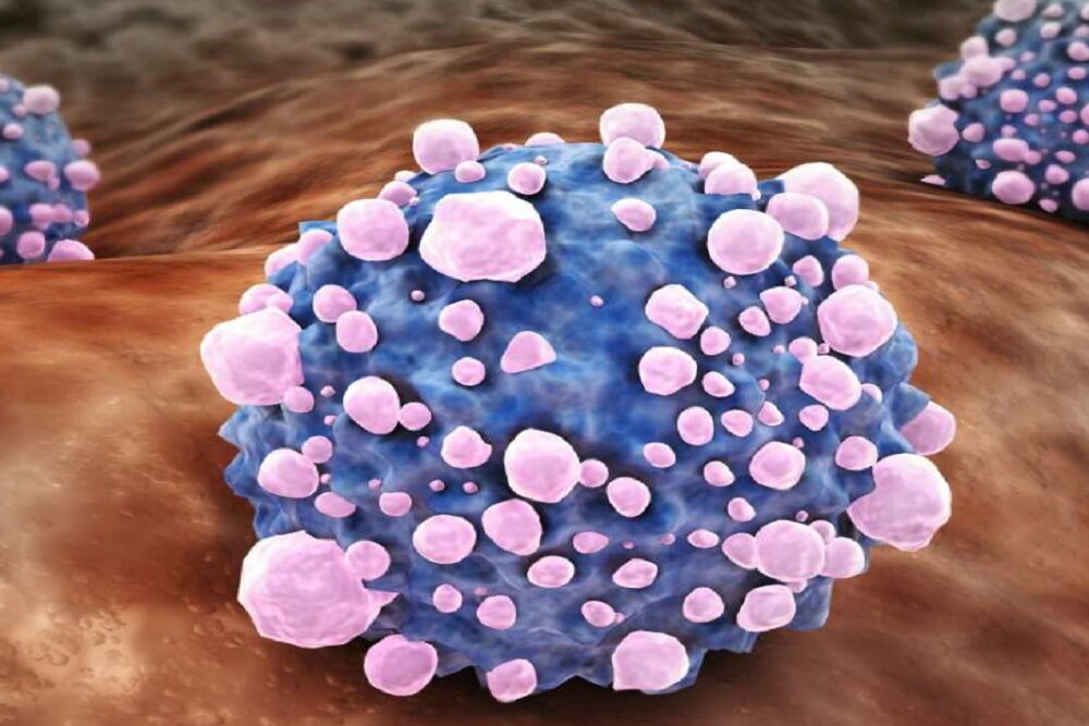 کشف عاملی که به متاستاز سرطان پانکراس منجر می‌شود