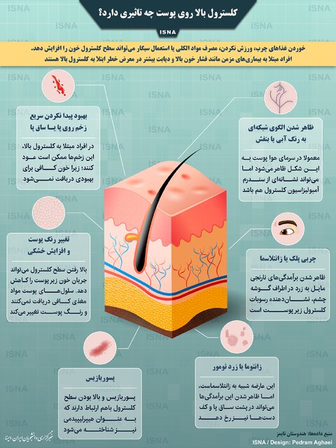 اینفوگرافیک / کلسترول بالا روی پوست چه تاثیری دارد؟
