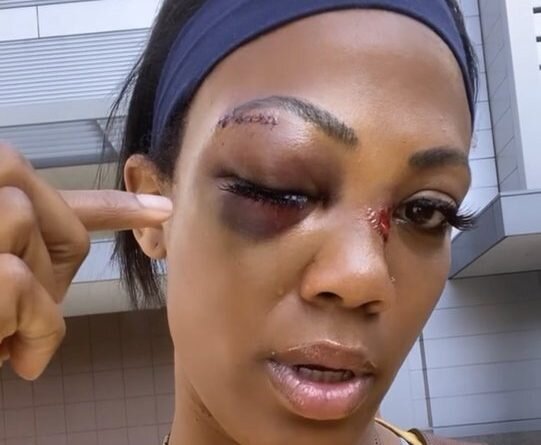 حمله خطرناک به بازیکن زن والیبال آمریکا