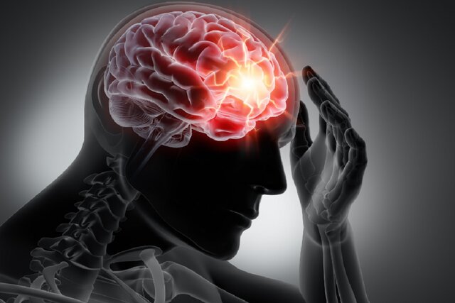 پنج عامل تحریککننده سردرد پنج عامل تحریککننده سردرد