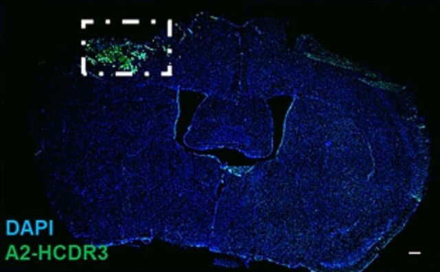 کشف سرنخهای مولکولی برای تشخیص زودهنگام آسیب مغزی