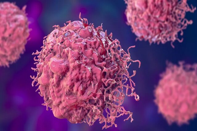 عکس خبر تزیینی است. وضعیت شیوع یک سرطان زنانه در ایران/احتمال ورود واکسن HPV به برنامه واکسیناسیون ملی