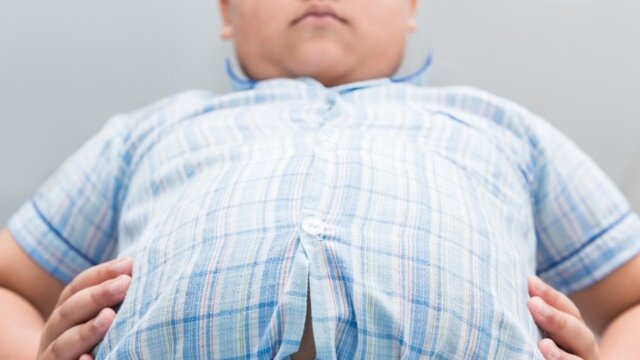 دستورالعمل جدید برای درمان کودکانِ چاق در آمریکا 