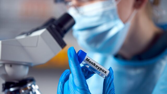 تایید ماندگاری ویروس آبله میمونی روی سطوح تایید ماندگاری ویروس آبله میمونی روی سطوح