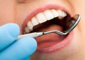 کاهش میزان پوسیدگی دندان در خراسان شمالی طی یک سال گذشته
