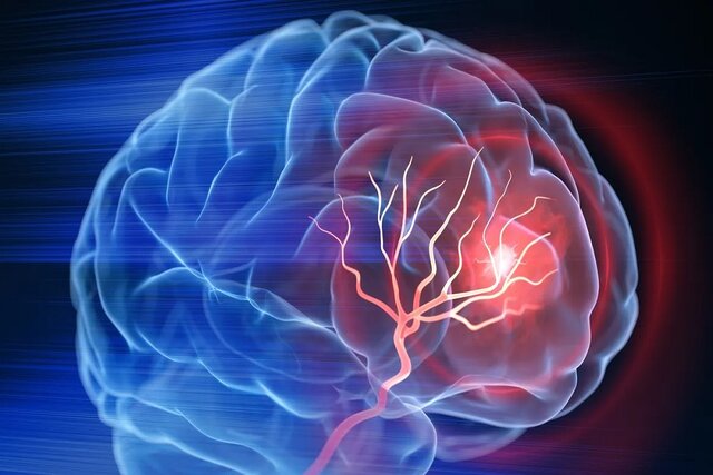 عکس تزیینی است. ابتلای هر ۷ دقیقه یک نفر به آلزایمر در کشور/ مهمترین نشانههای بروز این بیماری