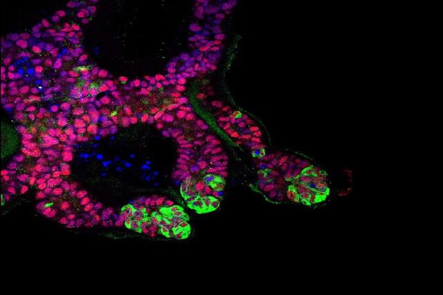 ارگانوئیدهای جوانه میزنای کلیه انسان که از سلولهای بنیادی مشتق شده است گامی مهم در جهت کِشت کلیه در آزمایشگاه برداشته شد