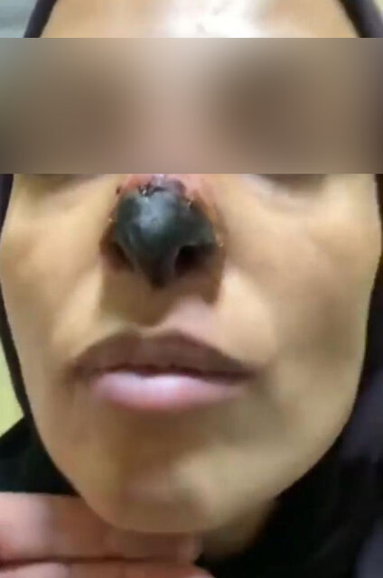 زیباییِ ارزان و تیغ پزشکنماها بر رخسار مردم