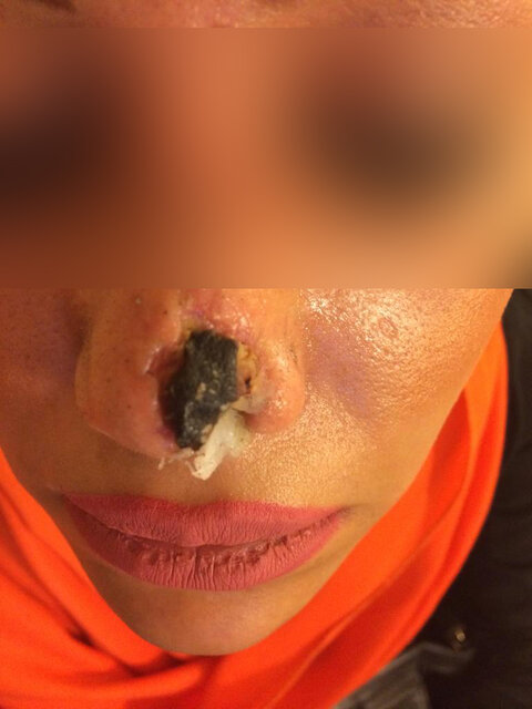 زیباییِ ارزان و تیغ پزشکنماها بر رخسار مردم