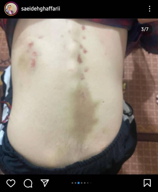 جزئیات حادثه ربودن و آزار یک جوان اوتیسمی/ درخواست برای شناسایی آدمربا