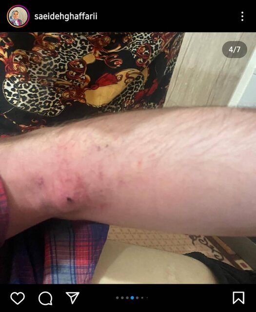 جزئیات حادثه ربودن و آزار یک جوان اوتیسمی/ درخواست برای شناسایی آدمربا