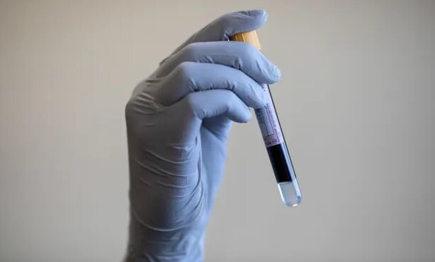 تست خون با قابلیت تشخیص چندین سرطان تست خون با قابلیت تشخیص چندین سرطان