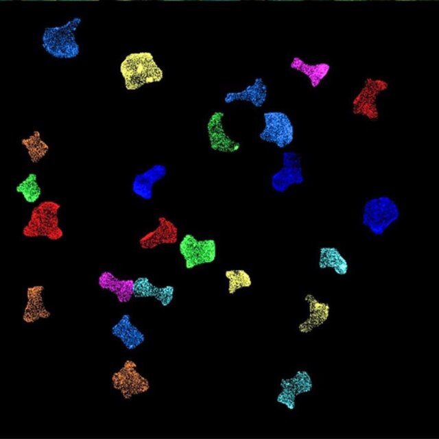 میکروژلهای ترمیمکننده آسیبهای مغزی