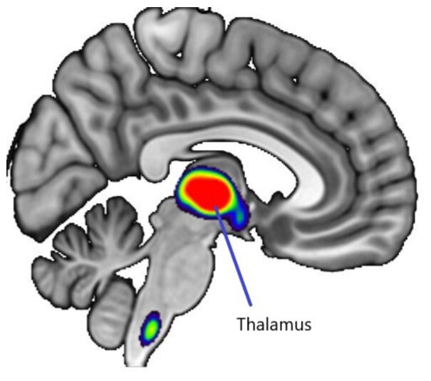 اثر نیکوتین سیگار بر کاهش تولید استروژن در زنان