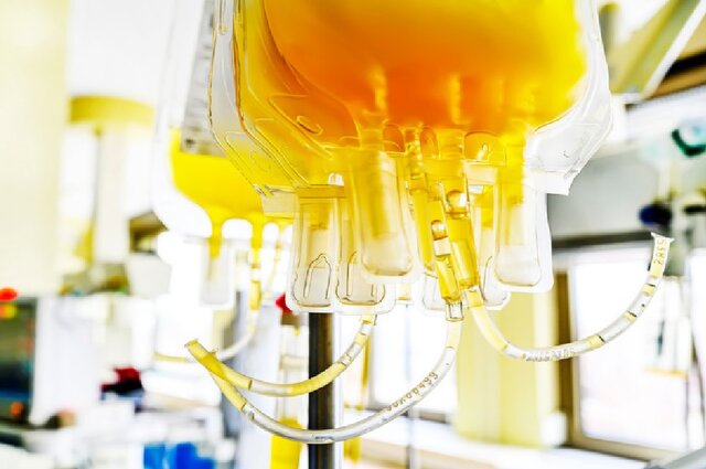 ایجاد سدهای بلند برای تولید داروهای مشتق از پلاسما/انتقاد از رویکردی که صنعت را نابود میکند ایجاد سدهای بلند برای تولید داروهای مشتق از پلاسما/انتقاد از رویکردی که صنعت را نابود میکند