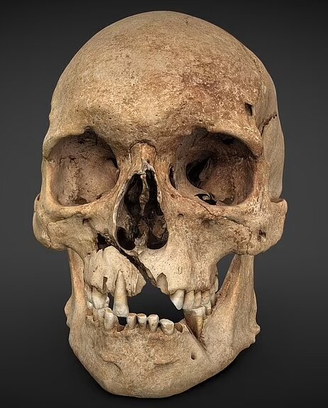 بازسازی صورت قربانی یک جنگ قرون وسطایی