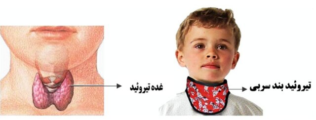 هشدار درباره پرتوگیریهای پزشکی غیرضرور / اهمیت «تیروئید بند سربی» در رادیولوژی دندانی