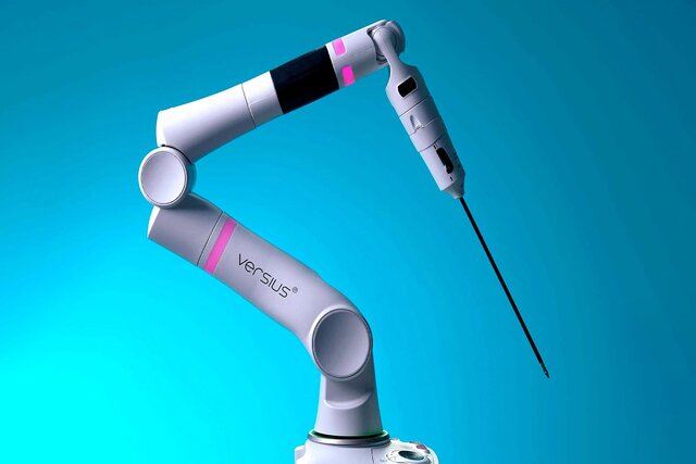 برداشتن تومور سرطانی توسط ربات جراح برای اولین بار