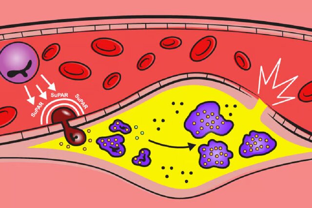 کشف پروتئینی که منجر به بیماری قلبی می‌شود