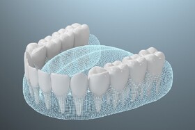 ابداع یک ماده ابریشمی برای پرکردن دندان