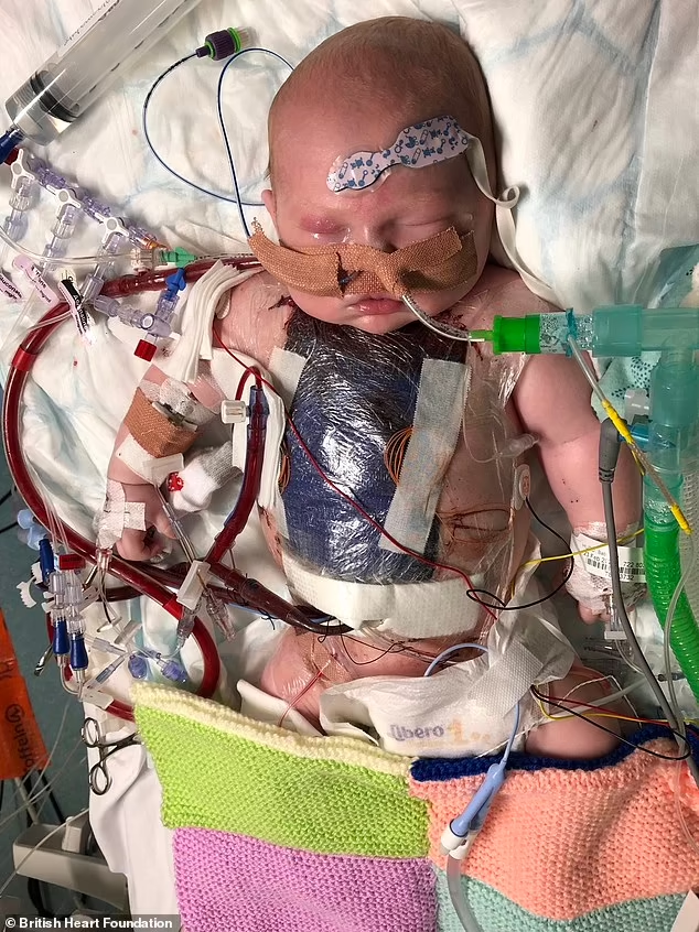 درمان عارضه قلبی یک نوزاد با سلولهای بنیادی جفت جنین برای اولین بار