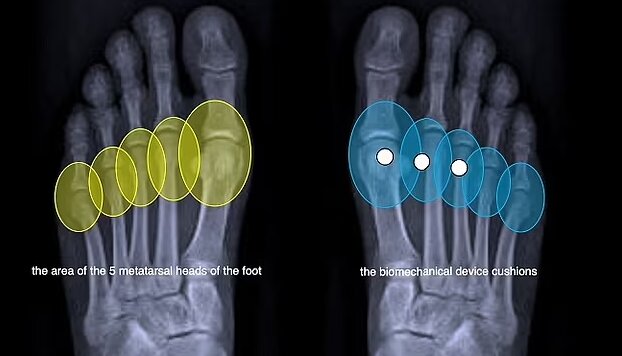 با کفشهای پاشنهبلند دردناک خداحافظی کنید!