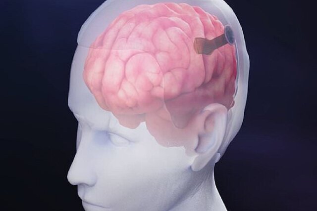 امکان استفاده از شبکههای اجتماعی با استفاده از ذهن برای بیماران فلج اندام امکان استفاده از شبکههای اجتماعی با استفاده از ذهن برای بیماران فلج اندام