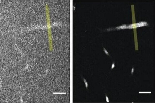 ثبت تصاویر دقیق از مغز با یک میکروسکوپ قوی ثبت تصاویر دقیق از مغز با یک میکروسکوپ قوی