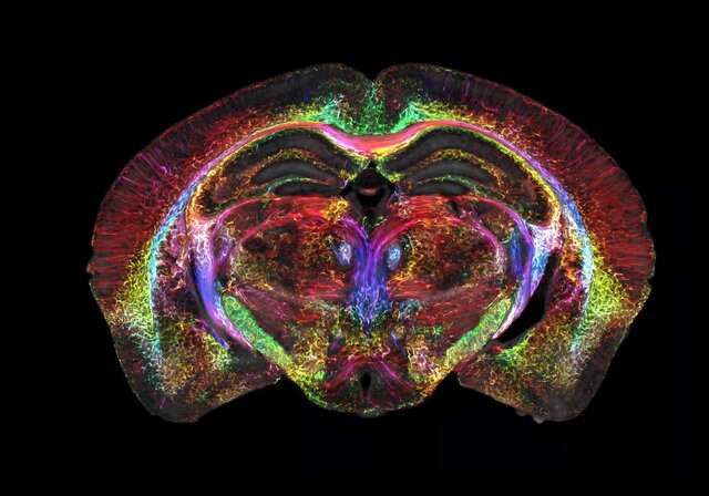 تصویربرداری از مغز ۶۴ میلیون برابر واضحتر از قبل