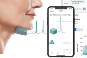 بهبود بلع در بیماران سرطانی با یک فناوری جدید