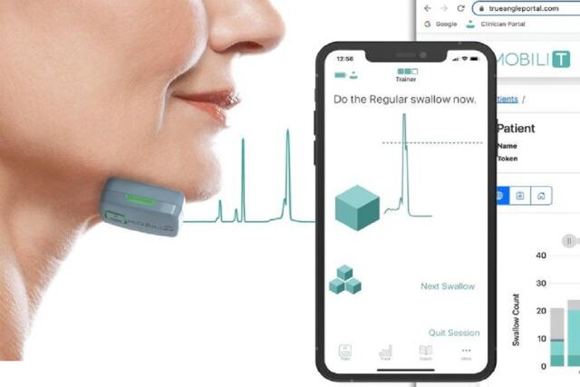 بهبود بلع در بیماران سرطانی با یک فناوری جدید