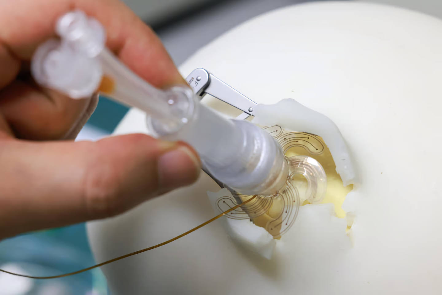 ابداع یک ایمپلنت مغزی کمتهاجمی