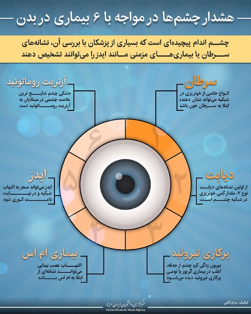 اینفوگرافیک / هشدار چشم‌ها در مواجه با ۶ بیماری در بدن