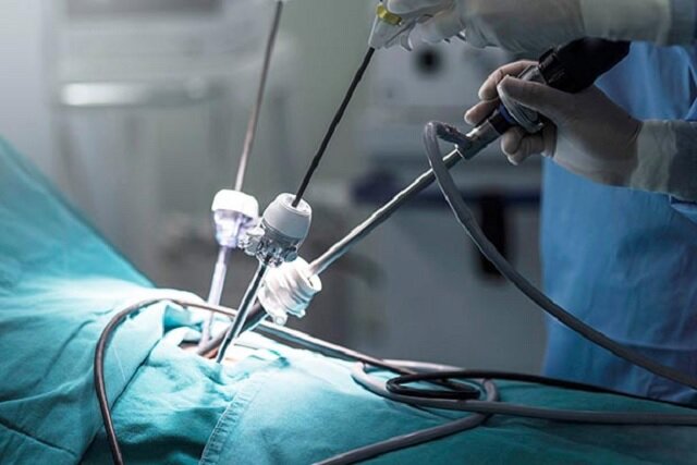 جشنواره فیلمهای لاپاراسکوپی زنان و اندومتریوز جشنواره فیلمهای لاپاراسکوپی زنان و اندومتریوز