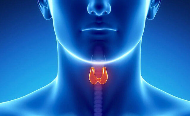 عکس تزیینی است. ۱۰ نشانه مخفی ابتلا به بیماری تیروئید