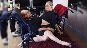 عجیبترین دوقلوهای جهان را بشناسید