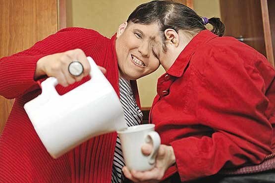 عجیبترین دوقلوهای جهان را بشناسید