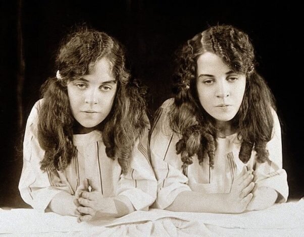 عجیبترین دوقلوهای جهان را بشناسید