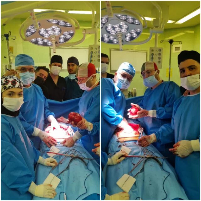 خارج کردن توده ۱/۵ کیلویی از کلیه بیمار ۵۲ ساله در بیمارستان امام رضا(ع) اردبیل