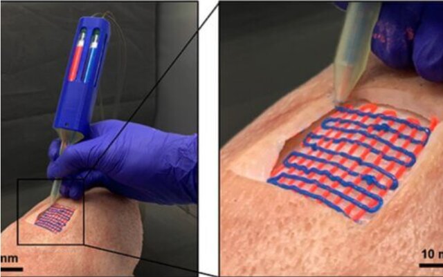 ابتکار دانشمند ایرانی در چاپ مستقیم بافتها و اندامها روی بدن