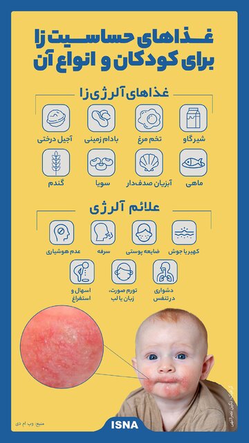 اینفوگرافیک / غذاهای حساسیت زا برای کودکان و انواع آن