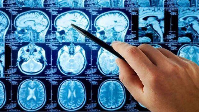 کارگاه عملی «هوش مصنوعی در MRI»