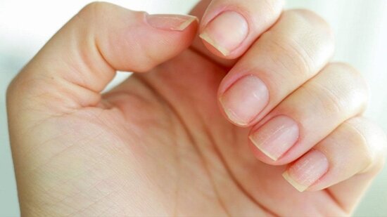 عکس تزیینی است. هشدار نسبت به ماده براقکننده و محکمکننده در کاشت ناخن و لاک ژل